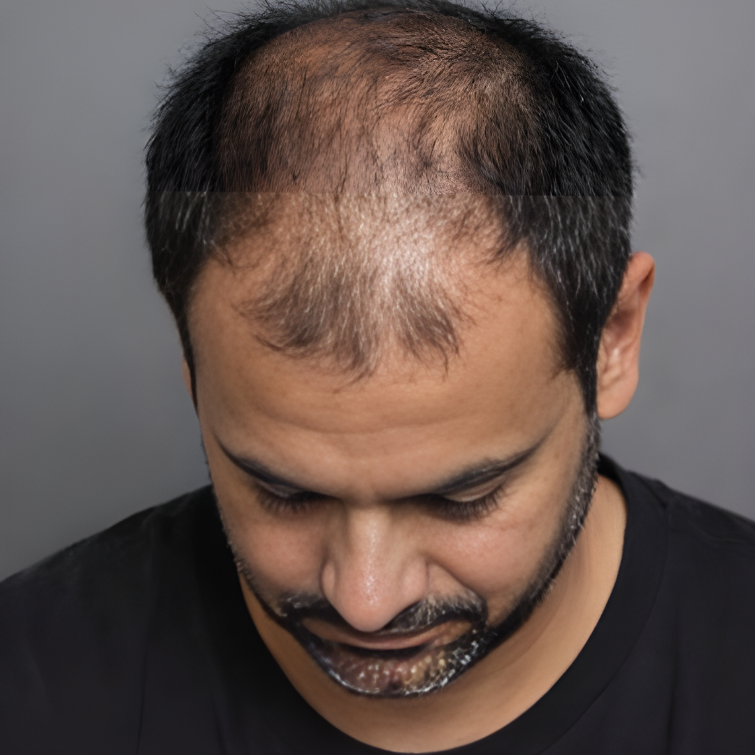 Untitled (1080 x 1080 px) (1)