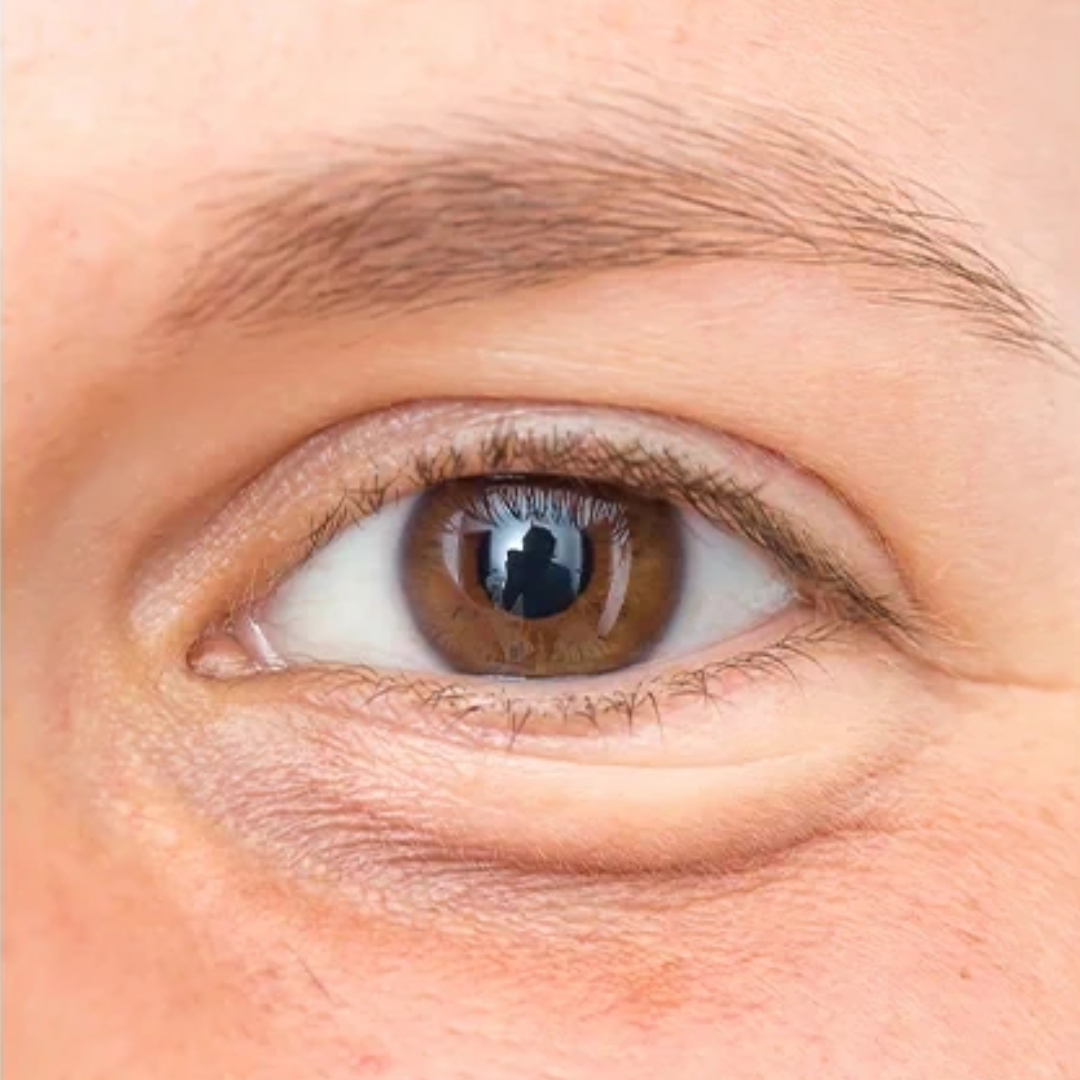 Untitled (1080 x 1080 px) (6)