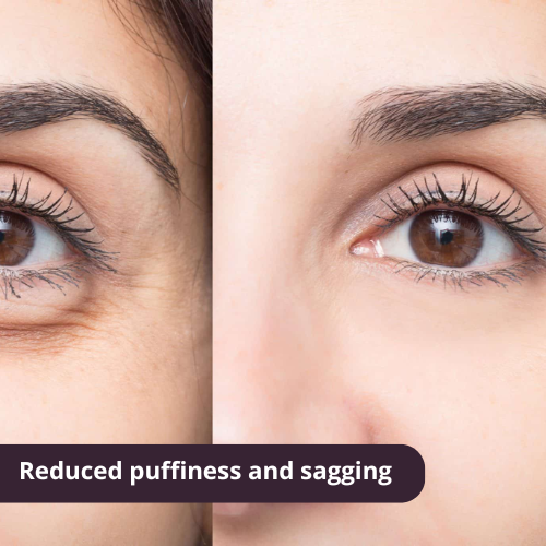 Post-injury care (1)