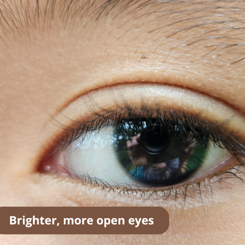 Post-injury care (8)