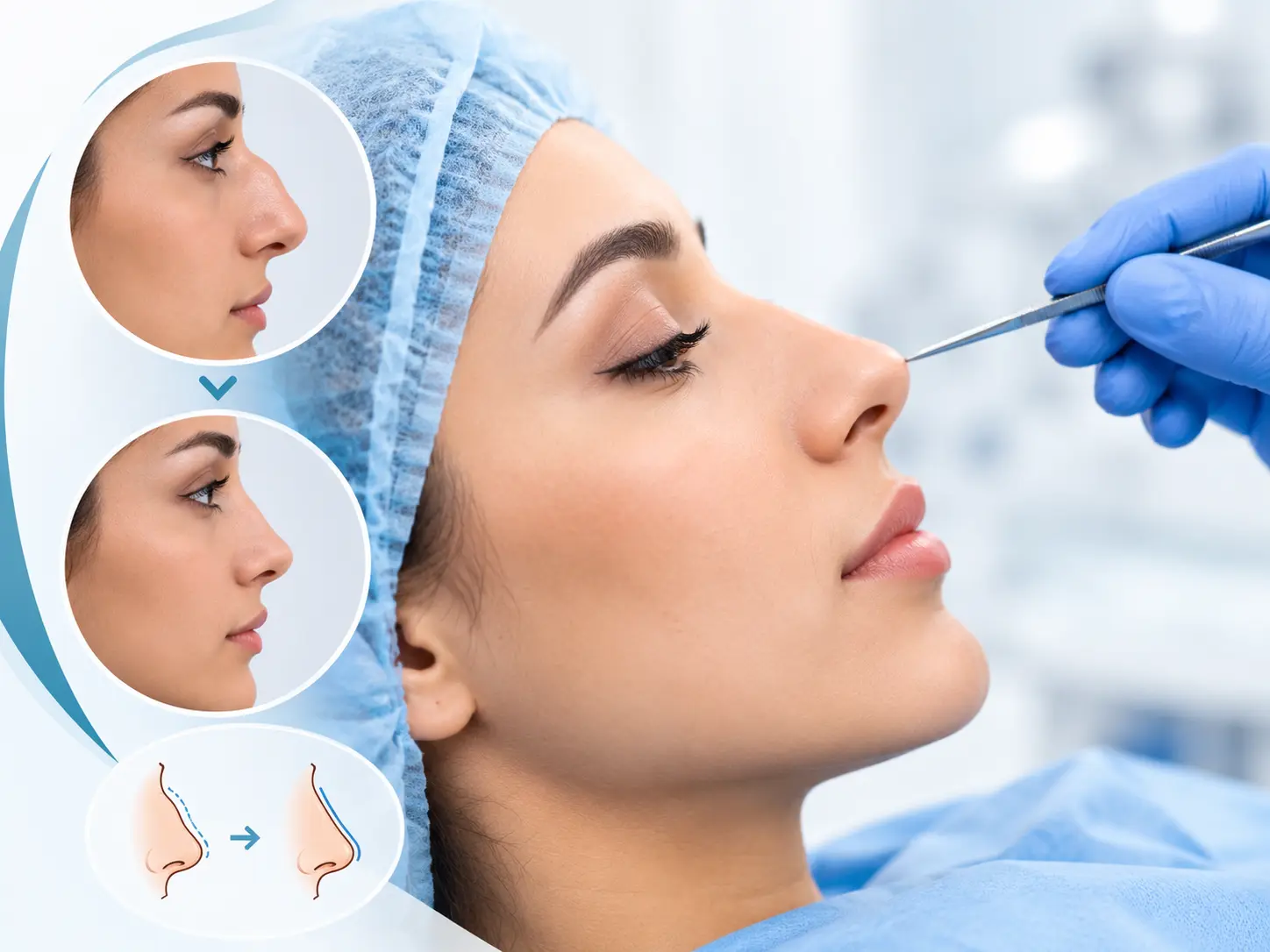 Rhinoplasty surgery in Amritsar at Beau & Belle Clinic